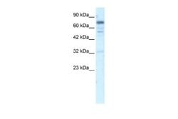 RIN3 Rabbit anti-Human, Polyclonal, Novus Biologicals 0.1ml; Unconjugated:Antibodies,